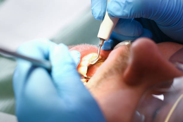 Best Broken Tooth Emergency  in Gouldtown, NJ